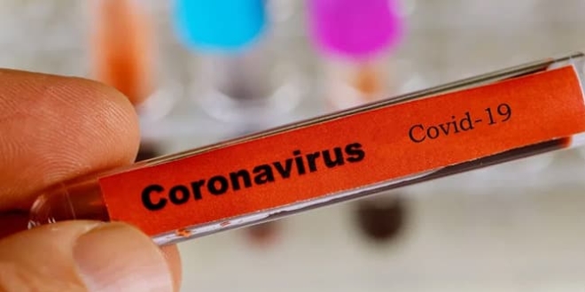 Coronavirüs “Tıbbi Kriteri”: Virüs 37,5 ℃ üzerinde bile var olabilir mi?